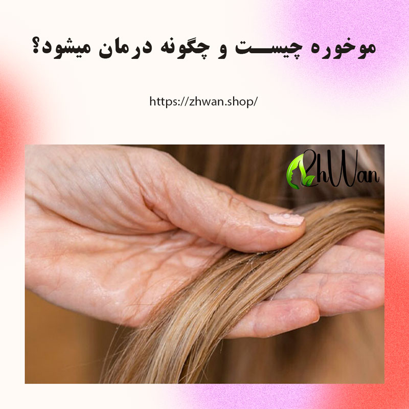 موخوره چیست و چگونه درمان میشود؟